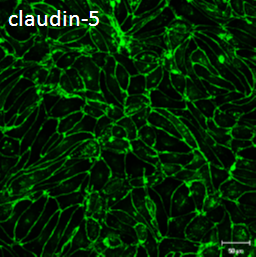 claudin-5